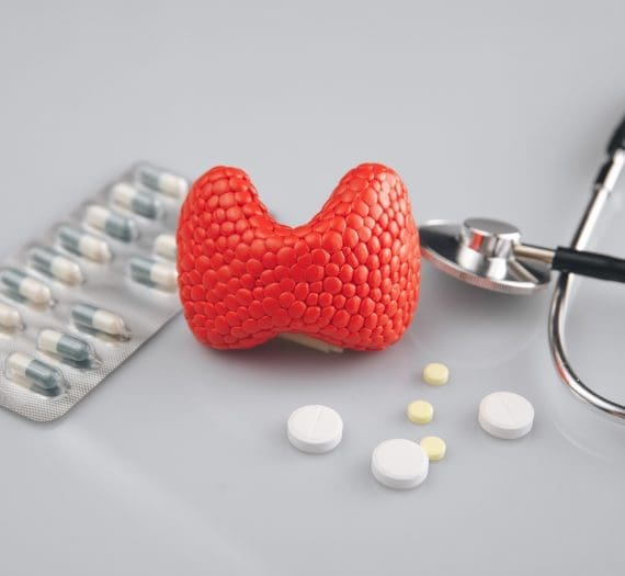 Hašimoto sindrom – šta je, koji su simptomi i kako se leči?